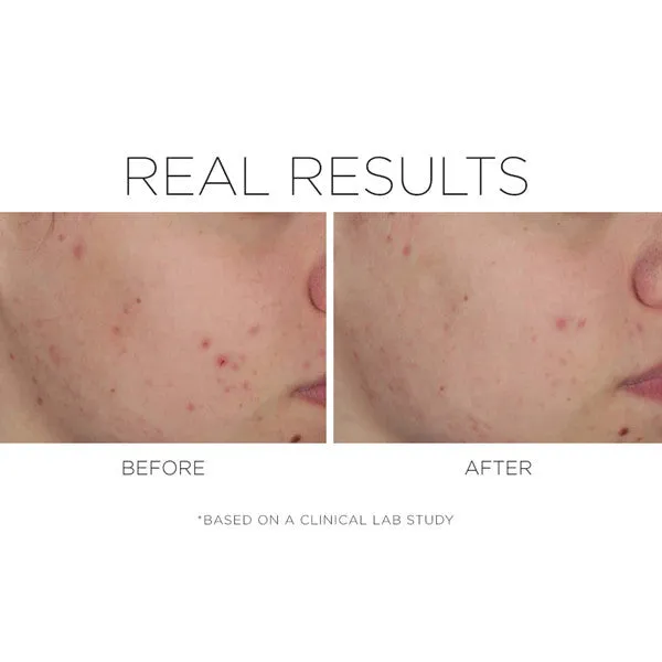 Cosmedix SHINELESS Oil-Free Moisturizer